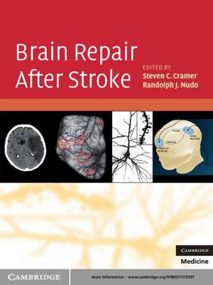 Cover of the book Brain Repair After Stroke by David de la Croix