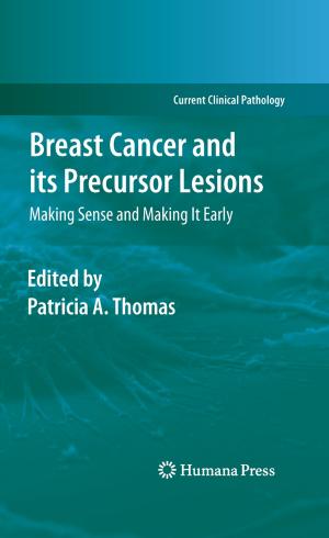 bigCover of the book Breast Cancer and its Precursor Lesions by 