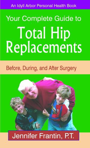 Cover of the book Your Complete Guide to Total Hip Replacements: Before, During, and After Surgery by Dr. Thomas Harding, Psy.D., M.A.