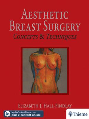 Book cover of Aesthetic Breast Surgery