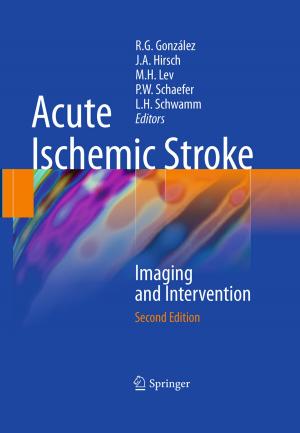 Cover of the book Acute Ischemic Stroke by J.W. Hand, K. Hynynen, P.N. Shrivastava, T.K. Saylor