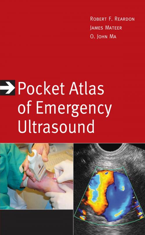 Cover of the book Pocket Atlas of Emergency Ultrasound by Robert F. Reardon, O. John Ma, James R. Mateer, McGraw-Hill Education