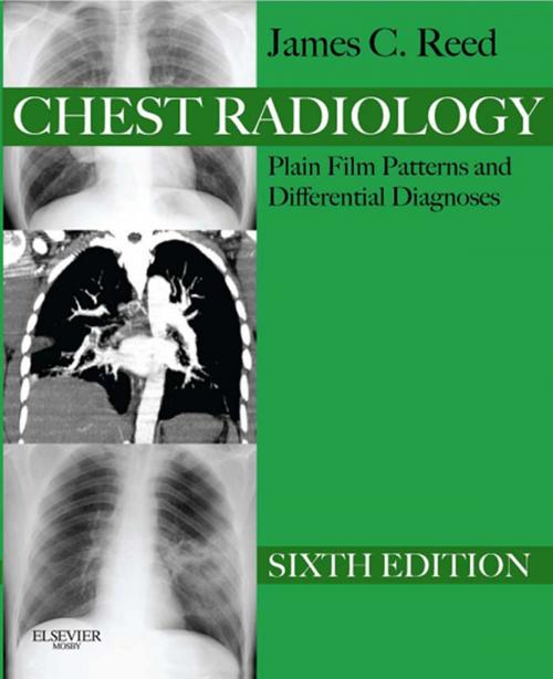 Cover of the book Chest Radiology Plain Film Patterns and Differential Diagnoses E-Book by James C. Reed, MD, Elsevier Health Sciences