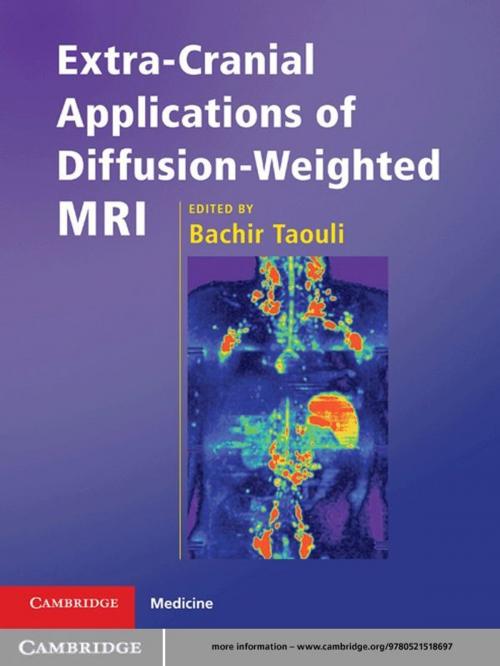 Cover of the book Extra-Cranial Applications of Diffusion-Weighted MRI by , Cambridge University Press