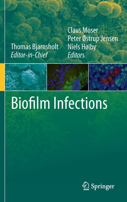 Cover of the book Biofilm Infections by , Springer New York