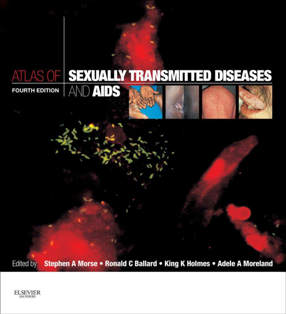Big bigCover of Atlas of Sexually Transmitted Diseases and AIDS