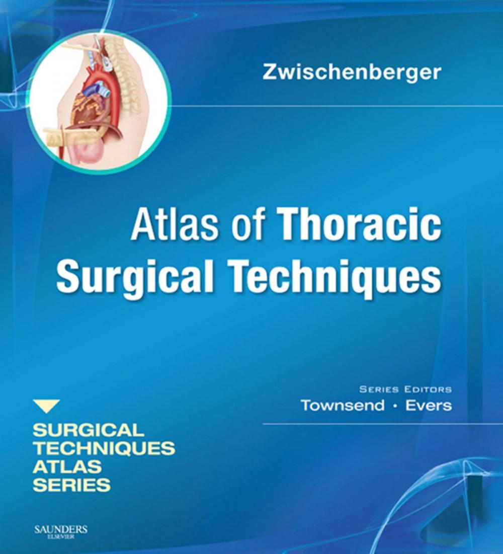 Big bigCover of Atlas of Thoracic Surgical Techniques E-Book