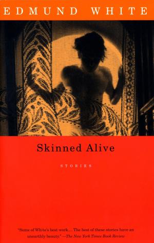 Book cover of Skinned Alive