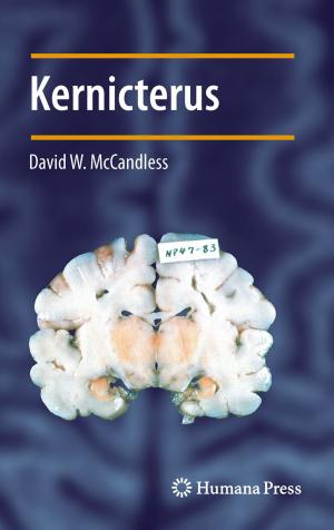 Cover of the book Kernicterus by Harold Miles