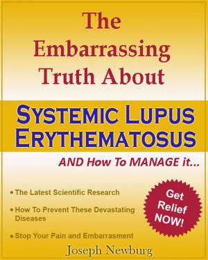 Book cover of The Embarrassing Truth About Systemic Lupus Erythematosus (SLE) and How to Manage It