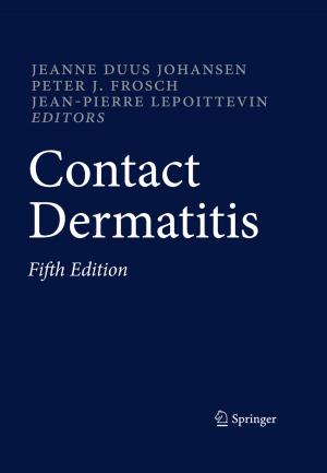 Cover of the book Contact Dermatitis by Guangquan Zhang, Jie Lu, Ya Gao
