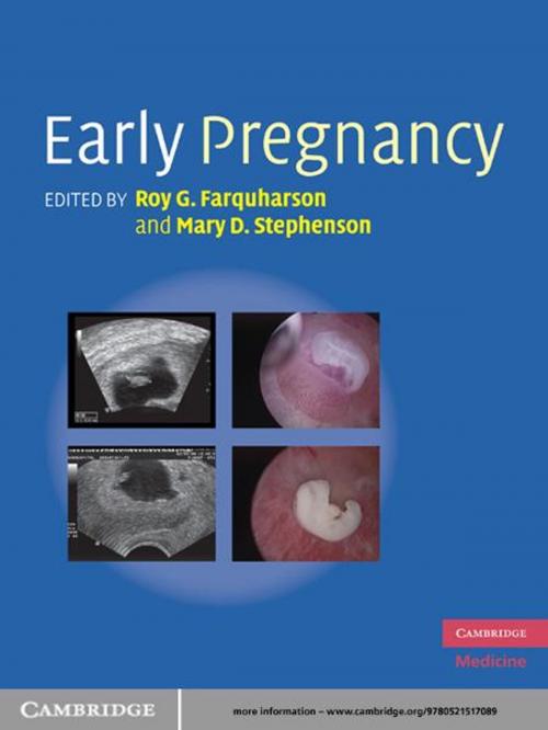 Cover of the book Early Pregnancy by , Cambridge University Press