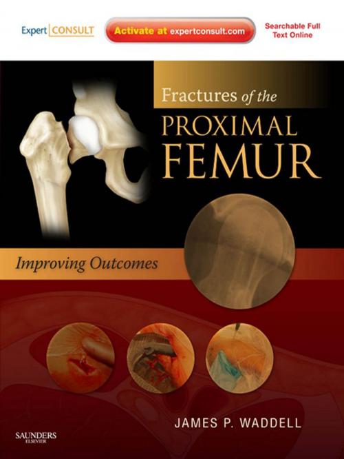 Cover of the book Fractures of the Proximal Femur: Improving Outcomes E-Book by James P. Waddell, Elsevier Health Sciences