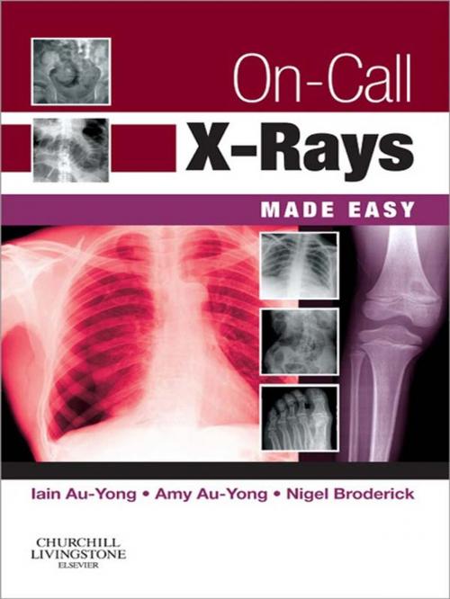 Cover of the book On-Call X-Rays Made Easy E-Book by Iain Au-Yong, MA, BMBCh, MRCS, FRCR, Amy Au-Yong, BSc(Hons), MBChB, Nigel Broderick, BS MB FRCR, Elsevier Health Sciences