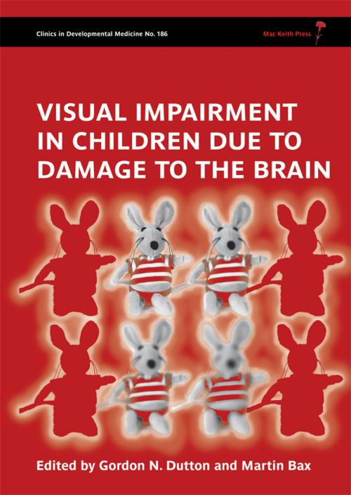 Cover of the book Visual Impairment in Children due to Damage to the Brain by , Mac Keith Press