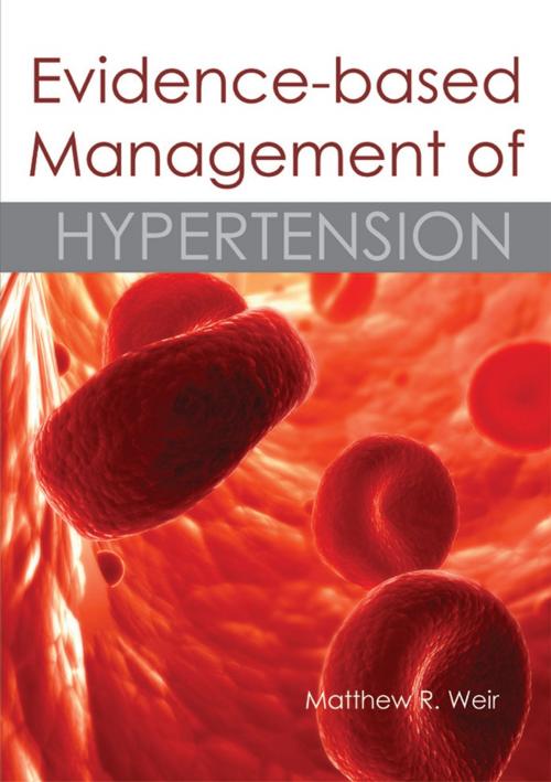Cover of the book Evidence-based Management of Hypertension by , tfm Publishing Ltd
