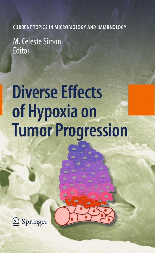 Cover of the book Diverse Effects of Hypoxia on Tumor Progression by , Springer Berlin Heidelberg