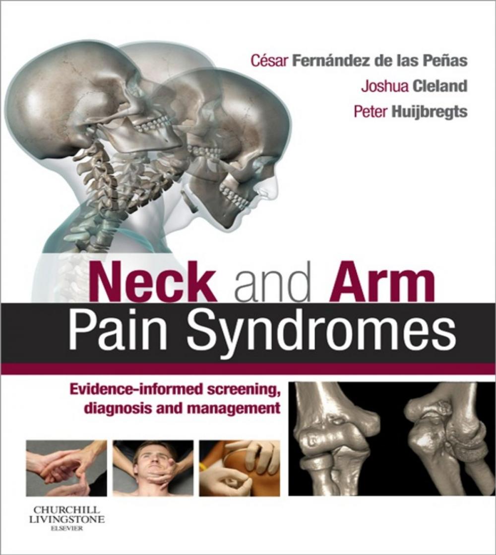 Big bigCover of Neck and Arm Pain Syndromes E-Book