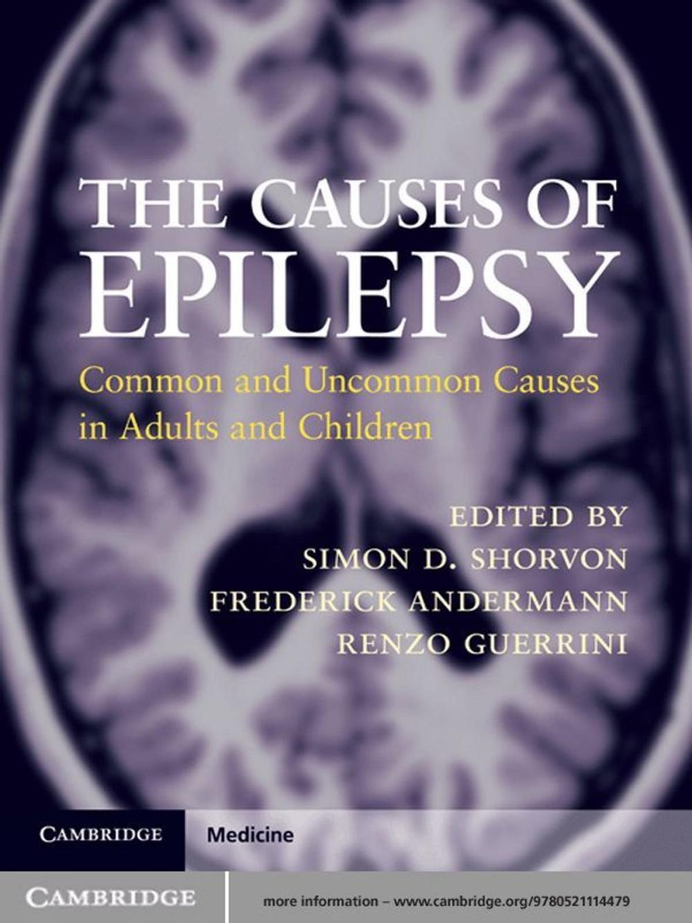 Big bigCover of The Causes of Epilepsy