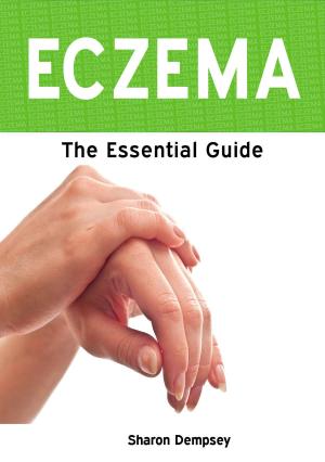 Cover of the book Eczema: The Essential Guide by Laura Gartside
