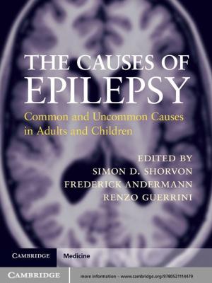 Cover of the book The Causes of Epilepsy by Keith N. Hylton