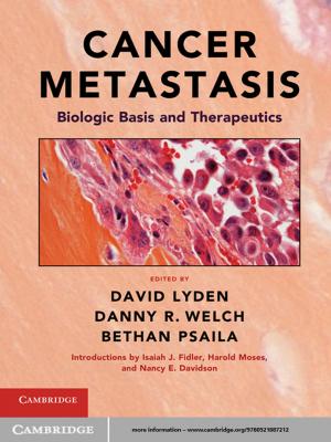 Cover of the book Cancer Metastasis by Charles H. Stocking