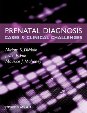 Cover of the book Prenatal Diagnosis by Mary Evans