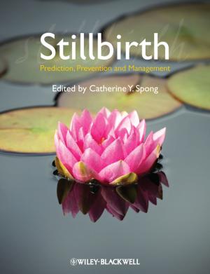 Cover of the book Stillbirth by Ian Cox, Marie A. Gaudard, Mia L. Stephens