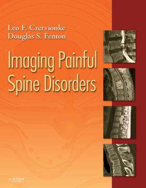 Cover of the book Imaging Painful Spine Disorders E-Book by John D. Mitchell, MD