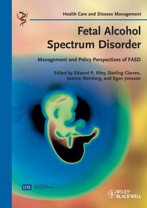 Cover of the book Fetal Alcohol Spectrum Disorder by 