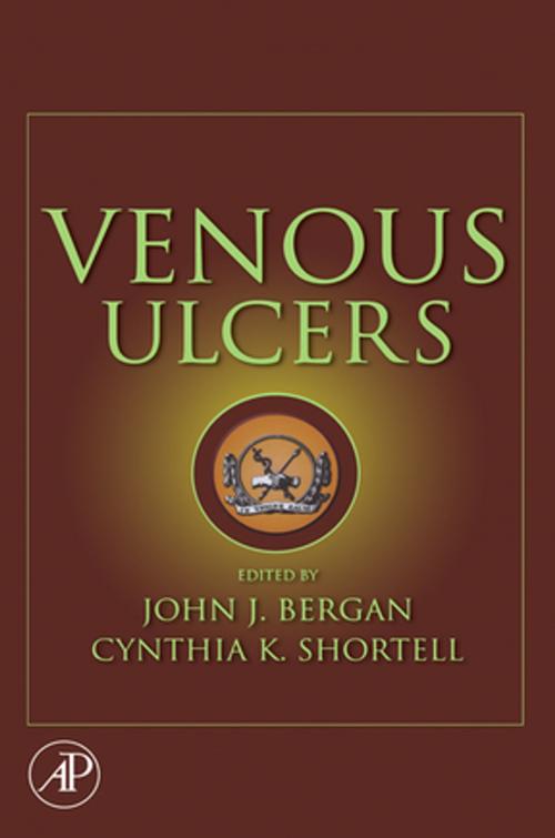 Cover of the book Venous Ulcers by , Elsevier Science