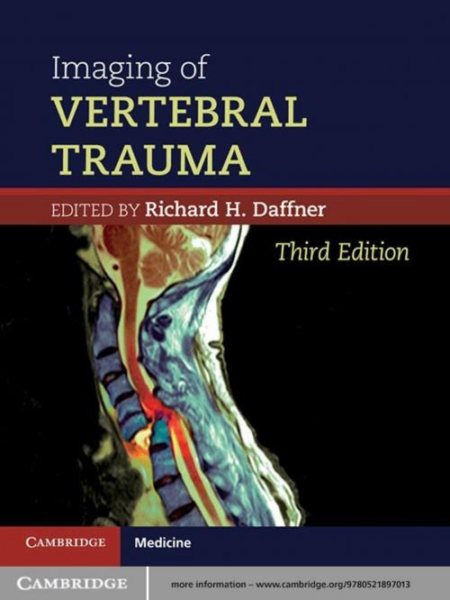 Cover of the book Imaging of Vertebral Trauma by Richard H. Daffner, MD, Cambridge University Press