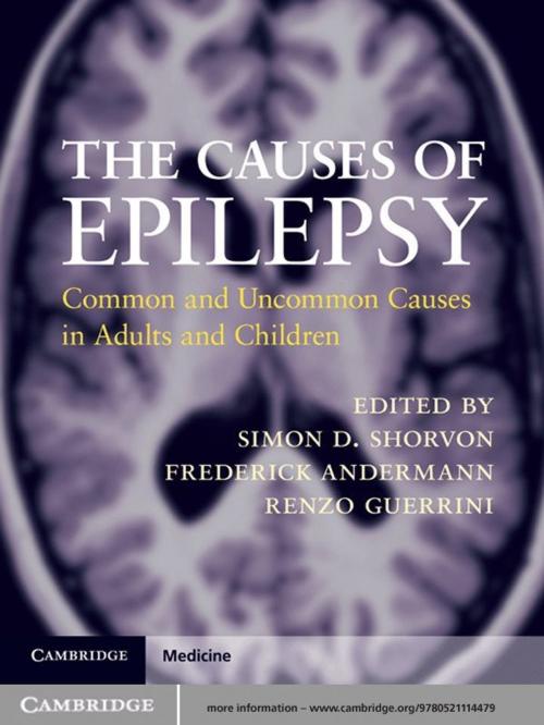 Cover of the book The Causes of Epilepsy by , Cambridge University Press