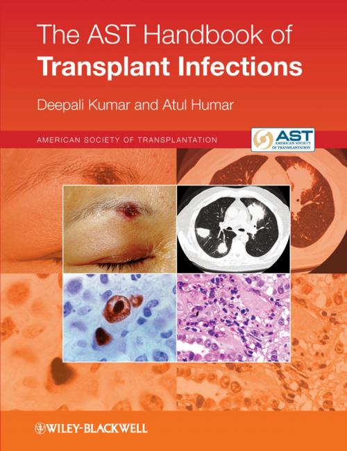Cover of the book The AST Handbook of Transplant Infections by Deepali Kumar, Atul Humar, Wiley