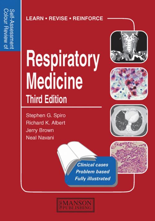 Cover of the book Respiratory Medicine by Jerry Brown, Neal Navani, Stephen Spiro, Richard Albert, CRC Press