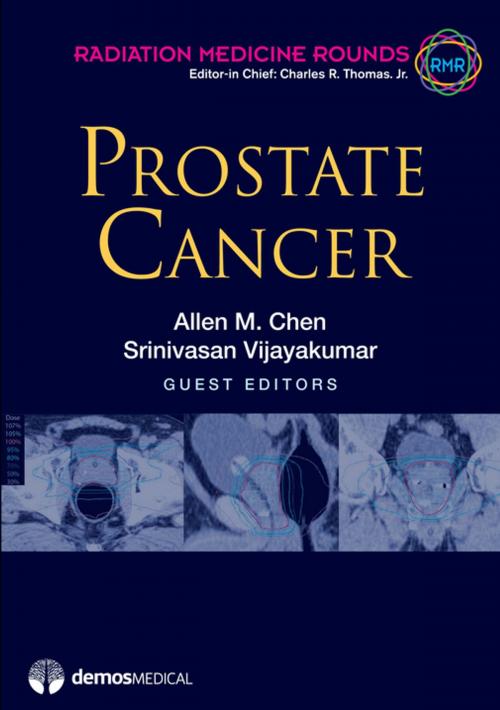 Cover of the book Prostate Cancer by Allen M. Chen, MD, Charles R. Thomas Jr., MD, Srinivasan Vijayakumar, MD, Springer Publishing Company
