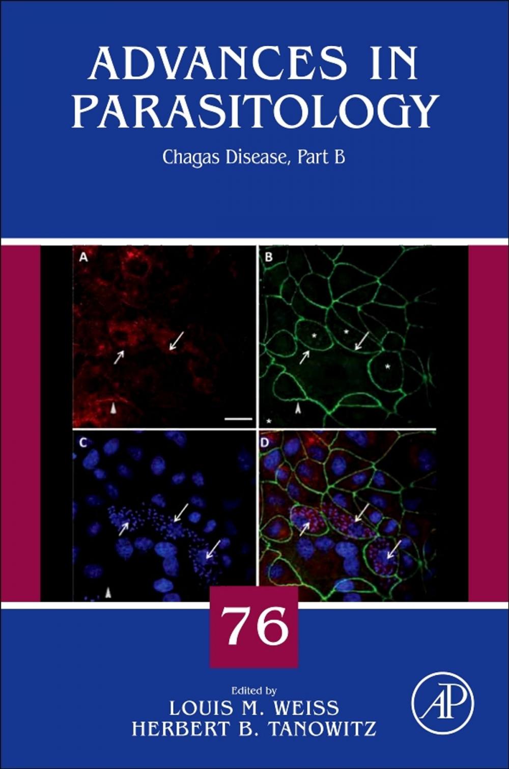 Big bigCover of Chagas Disease