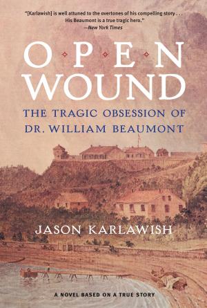 Cover of the book Open Wound by Davis B. Bobrow, Mark A. Boyer