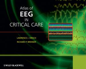 Cover of the book Atlas of EEG in Critical Care by Lars Engle, Eric Rasmussen