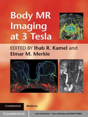 Cover of the book Body MR Imaging at 3 Tesla by Phil Gregory