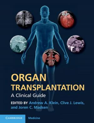 Cover of the book Organ Transplantation by K. F. Riley, M. P. Hobson