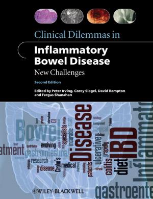 Cover of the book Clinical Dilemmas in Inflammatory Bowel Disease by Rutger A. van Santen