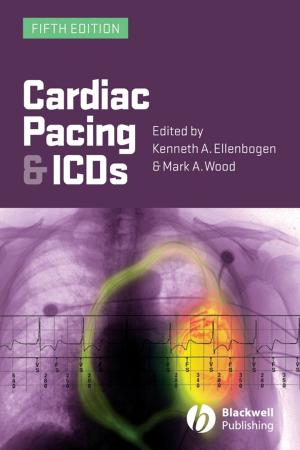 Book cover of Cardiac Pacing and ICDs