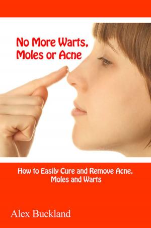 Book cover of No More Warts, Moles or Acne