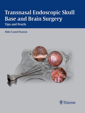Cover of the book Transnasal Endoscopic Skull Base and Brain Surgery by Hedwig Manz