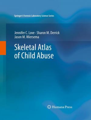 Cover of the book Skeletal Atlas of Child Abuse by 