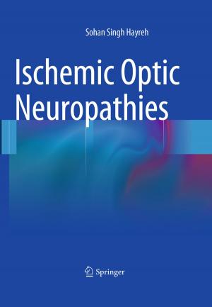 Book cover of Ischemic Optic Neuropathies
