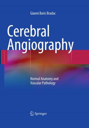 Cover of the book Cerebral Angiography by Martina Staudhammer