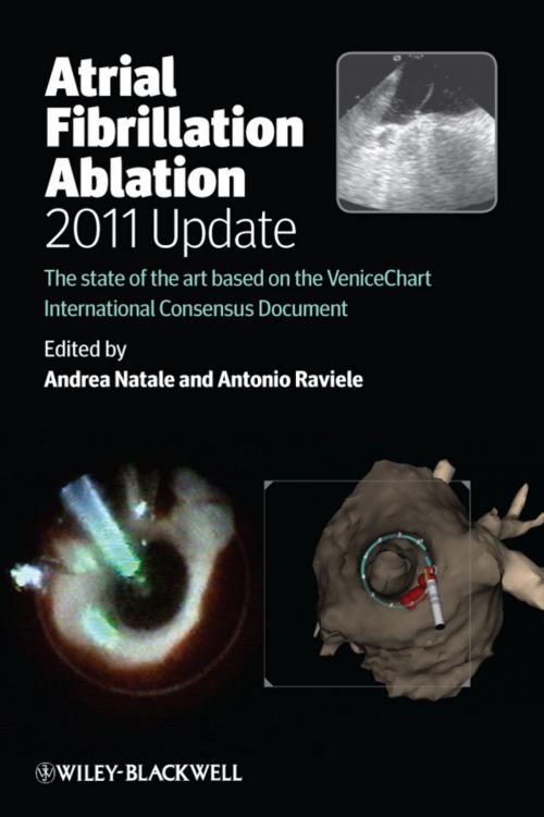 Cover of the book Atrial Fibrillation Ablation, 2011 Update by , Wiley