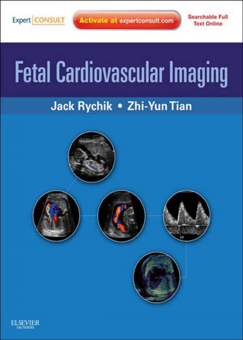 Cover of the book Fetal Cardiovascular Imaging E-Book by Jack Rychik, MD, FACC, Zhiyun Tian, MD, RDCS, Elsevier Health Sciences